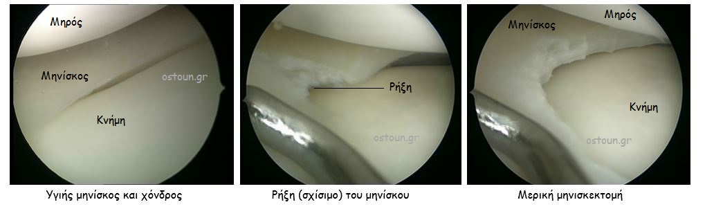 TAPSIS A. KONSTANTINOS: Φωτογραφίες & Βίντεο