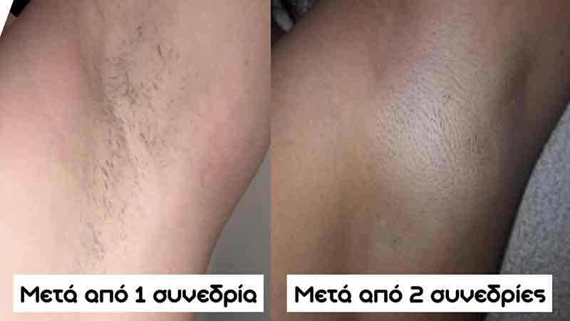 THE BEAUTY SPOT: Φωτογραφίες & Βίντεο