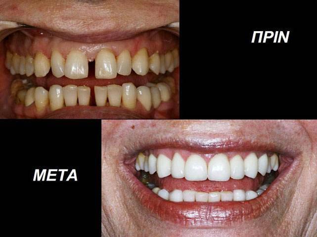 THE DENTAL CLINIC - ΚΑΛΤΣΑΣ ΑΛΕΞΑΝΔΡΟΣ: Φωτογραφίες & Βίντεο