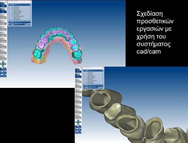 THE DENTAL CLINIC - ΚΑΛΤΣΑΣ ΑΛΕΞΑΝΔΡΟΣ: Φωτογραφίες & Βίντεο