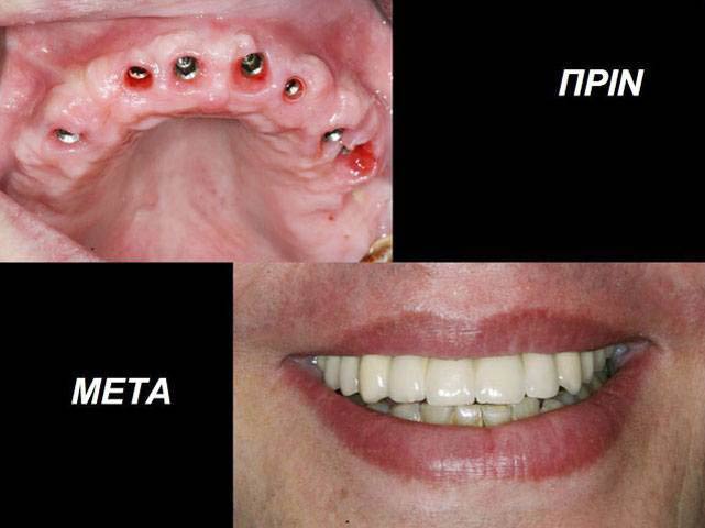 THE DENTAL CLINIC - ΚΑΛΤΣΑΣ ΑΛΕΞΑΝΔΡΟΣ: Φωτογραφίες & Βίντεο