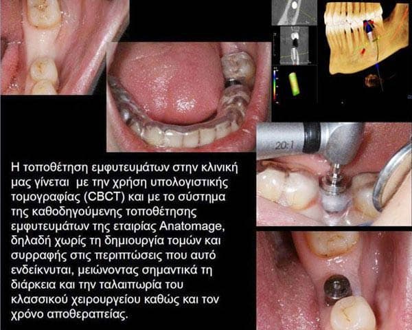 THE DENTAL CLINIC - ΚΑΛΤΣΑΣ ΑΛΕΞΑΝΔΡΟΣ: Φωτογραφίες & Βίντεο