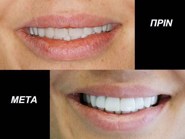 THE DENTAL CLINIC - ΚΑΛΤΣΑΣ ΑΛΕΞΑΝΔΡΟΣ: Φωτογραφίες & Βίντεο
