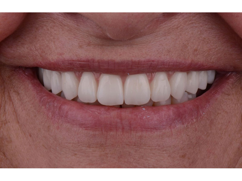 THE DENTAL HUB - GAKIS P. PANAGIOTIS: Φωτογραφίες & Βίντεο