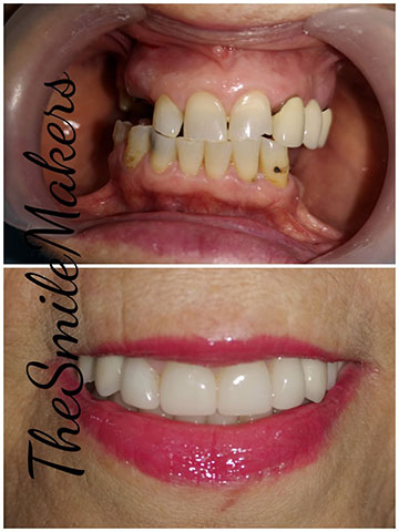 THE SMILE MAKERS - MOULAVASILI - BARDI PANAGIOTA Dr - BARDIS DIMITRIOS: Φωτογραφίες & Βίντεο