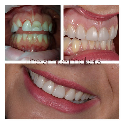 THE SMILE MAKERS - MOULAVASILI - BARDI PANAGIOTA Dr - BARDIS DIMITRIOS: Φωτογραφίες & Βίντεο