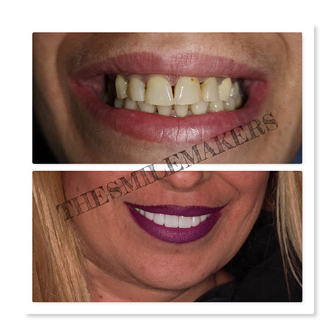 THE SMILE MAKERS - MOULAVASILI - BARDI PANAGIOTA Dr - BARDIS DIMITRIOS: Φωτογραφίες & Βίντεο
