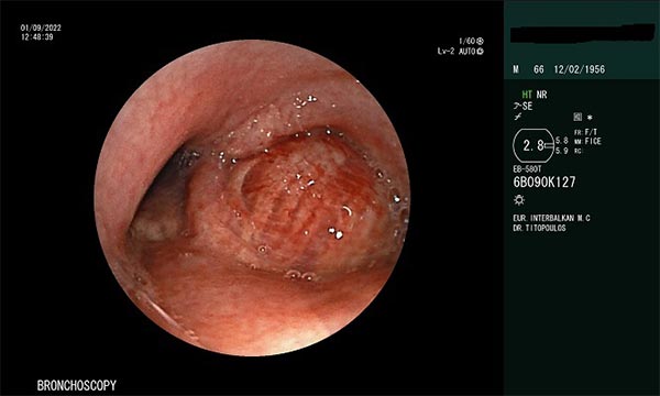 TITOPOULOS IRAKLIS MD, PhD: Φωτογραφίες & Βίντεο