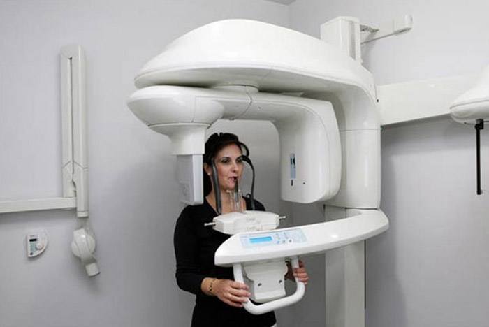 Orthopantograph department for cephalometric X-rays