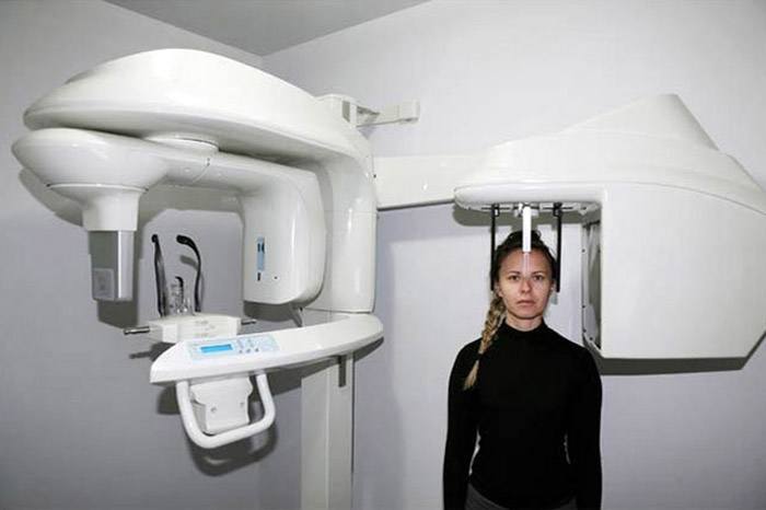 Orthopantograph for panoramic X-rays