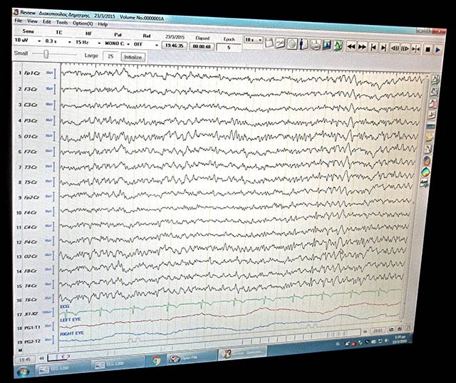 ΤΣΟΥΝΗΣ ΣΤΕΦΑΝΟΣ Dr, MD, PhD: Φωτογραφίες & Βίντεο