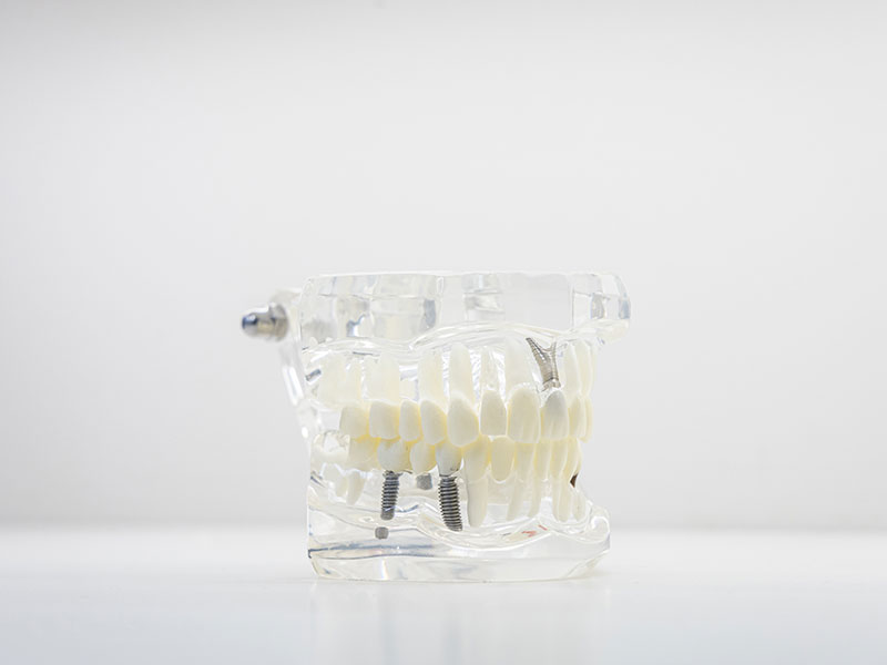 VAGDOUTI TRIANTAFYLLIA DDS MSc - ORTHO PERIO VOLOS: Φωτογραφίες & Βίντεο