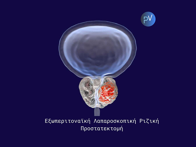 VEVELOGIANNIS PANAGIOTIS: Φωτογραφίες & Βίντεο