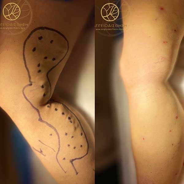 Before and after
