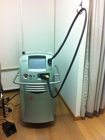 Laser Candela