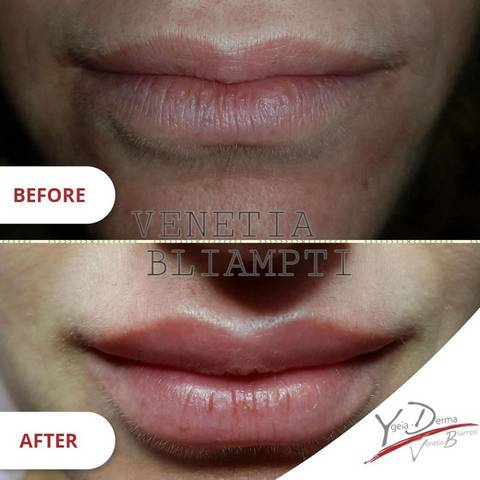 YGEIA DERMA - BLIAMPTI VENETIA: Φωτογραφίες & Βίντεο