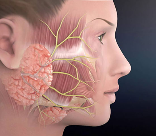 Restoration of the facial nerve