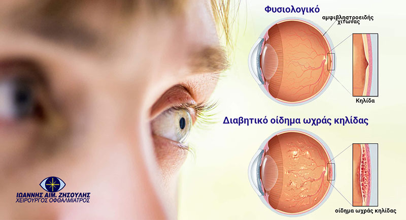 ΖΗΣΟΥΛΗΣ ΙΩΑΝΝΗΣ: Φωτογραφίες & Βίντεο