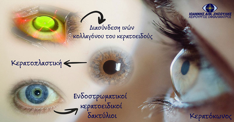 ΖΗΣΟΥΛΗΣ ΙΩΑΝΝΗΣ: Φωτογραφίες & Βίντεο
